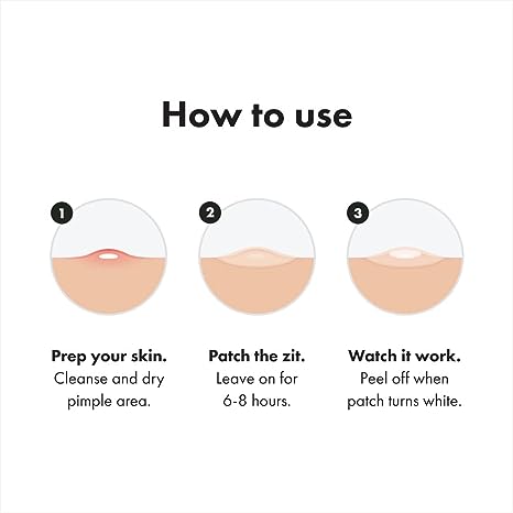 Mighty Patchâ„¢ Original patch from Hero Cosmetics – Hydrocolloid Acne Pimple Patch for Covering Zits and Blemishes, Spot Stickers for Face and Skin, Vegan-friendly and Not Tested on Animals (36 Count)
