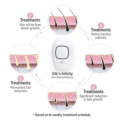 Silk’n Infinity – At Home Permanent Hair Removal for Women and Men, Lifetime of Pulses, No Refill Cartridge Needed, Unlimited Flashes – IPL Laser Hair Removal System