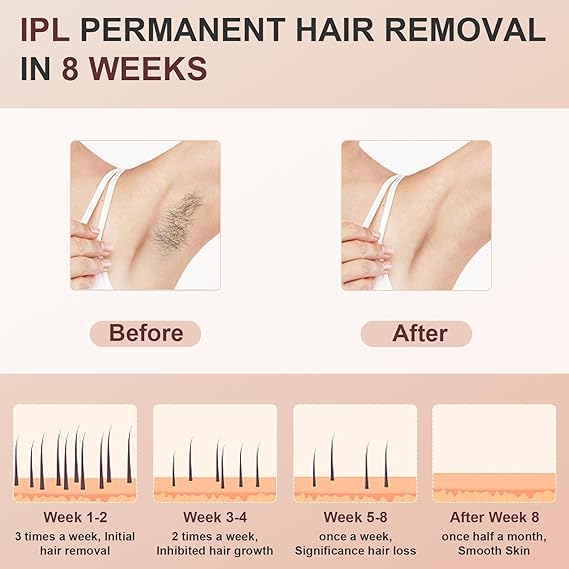 Laser Hair Removal, Permanent Hair Removal Device, Painless At-Home IPL Hair Removal for Women and Men for Face Armpits Legs Arms Bikini Line