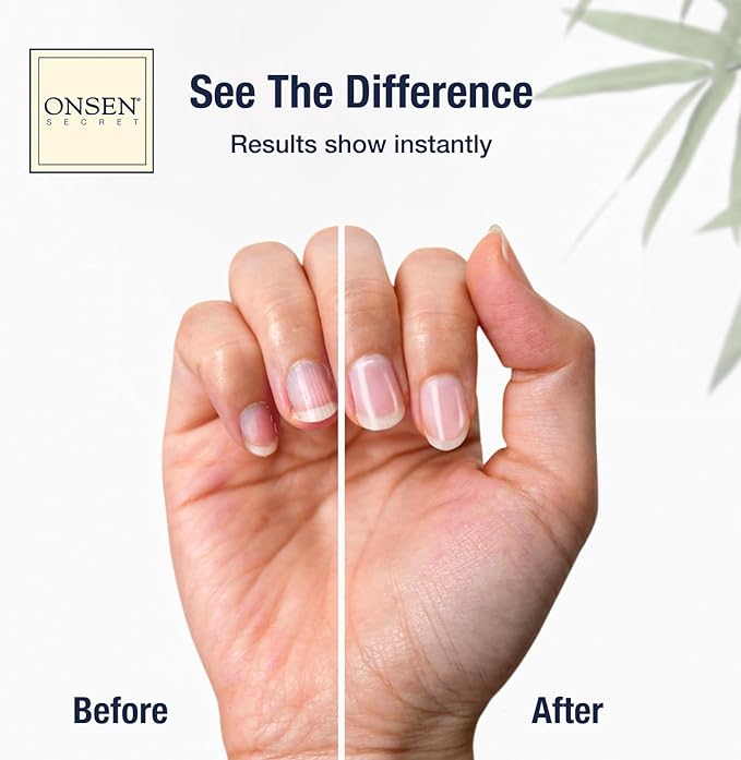 Onsen Secret Ultimate Nail Reboot Kit – Professional Nail File and Buffer, 3-Way Block w/Replacement Pads, Nail Strengthening Cuticle Cream, Reboot Oil & Anti Aging Hand Lotion