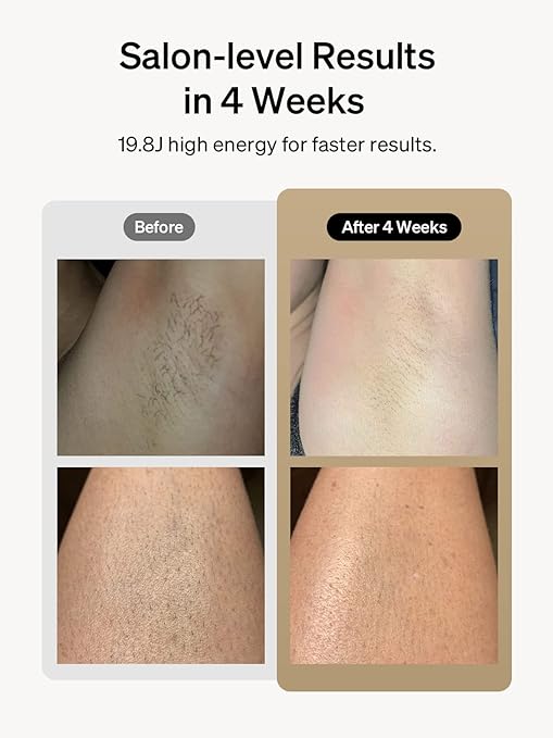 Ulike Laser Hair Removal for Women and Men, Air+ IPL Hair Removal Device with Sapphire Ice-Cooling Technology for Nearly Painless Result, Safe&Long-Lasting for Reducing in Hair Growth for Body & Face