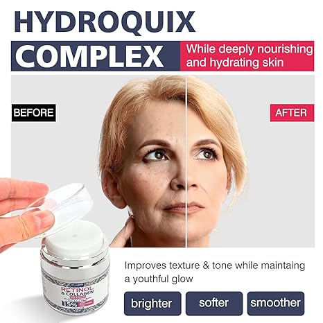 Retinol Cream for Face with Hyaluronic Acid – Collagen Face Moisturizer for Women and Men – Anti Aging Cream for Lifting Skin â€“ For Wrinkles, Fine Lines and Dryness – All Skin Types