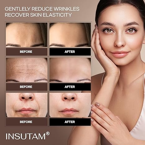 Insutam Forehead Wrinkle Patches Treatment: Face Tape for Wrinkles – Anti Wrinkle Patches – Wrinkle Patches for Face Overnight Forehead Wrinkles Treatment Facial Patch for Skin Beauty Remover for Laugh Lines 36pcs