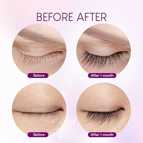 Premium Eyelash Serum by VieBeauti – Lash Boosting Serum for Longer Fuller Thicker Looking Lashes (3ML)
