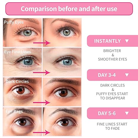 BREYLEE Rose Eye Maskâ€“ 30 Pairs – Eye Treatment Mask, Under Eye Bags Treatment, Under Eye Masks for Puffy Eyes, Anti-Aging,Anti-Wrinkle and Fine Lines, Under eye Dark Circles