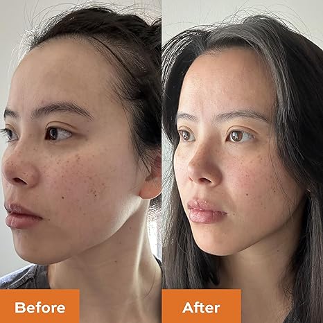 KNOW Beauty Arctic Gold Vitamin C Mask – Brighten Dull Skin, Remove Dark Spots and Pigmentation, Reverse Sun Damage, Boost Collagen, For All Skin Types – With Cloudberry and Tetrahexyldecyl Ascorbate